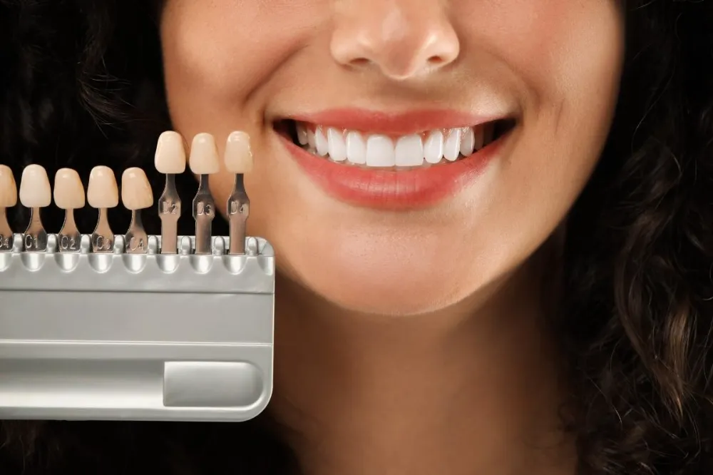 Gülüş Tasarımı Nedir?