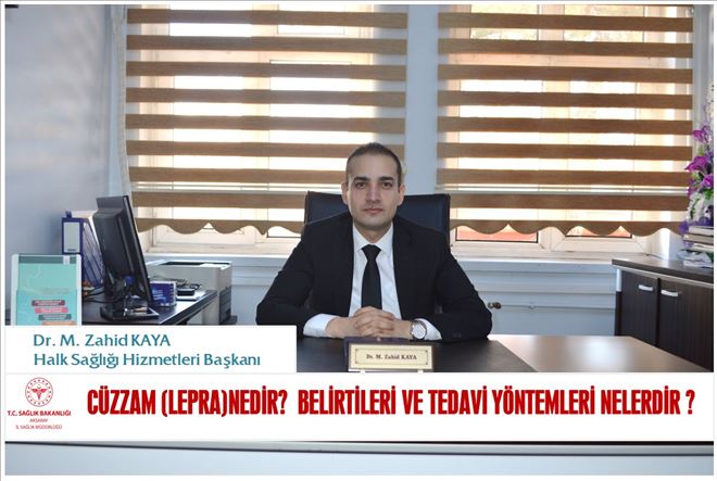 Cüzzam (lepra)nedir? Belirtileri ve tedavi yöntemleri nelerdir ?